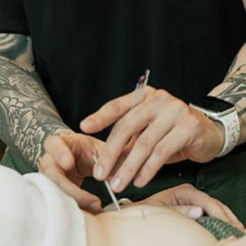 Feel Good Acupuncture &amp; Wellness
